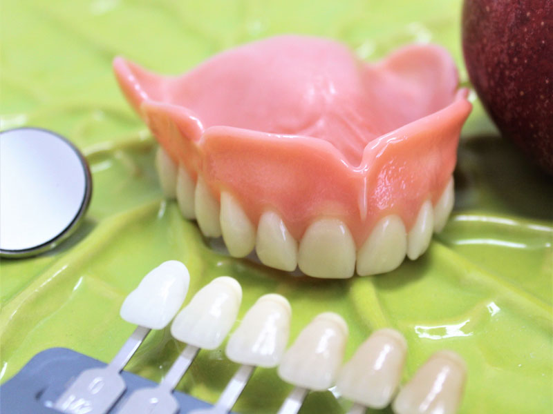 Praxis für Zahnprothetik - Oberkiefer Totalprothese